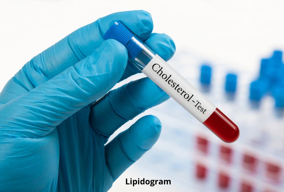 Probówka do lipidogramu, czyli badania pozwalającego określić poziom cholesterolu i
triglicerydów we krwi
